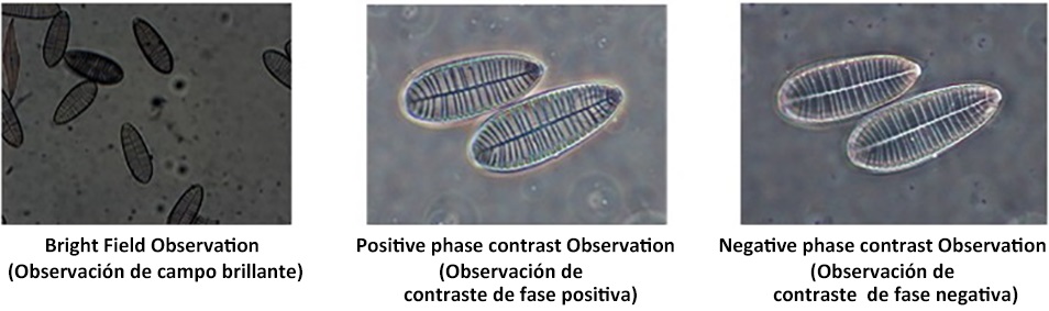 Picture taken with XD-3 inverted biological microscope